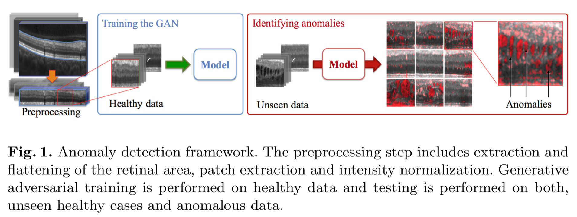 論文まとめ：Unsupervised Anomaly Detection with Generative Adversarial ...